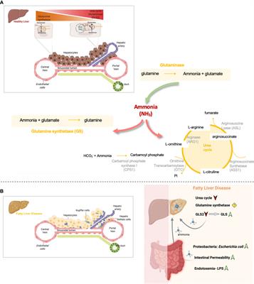 Understanding gut-liver axis nitrogen metabolism in Fatty Liver Disease